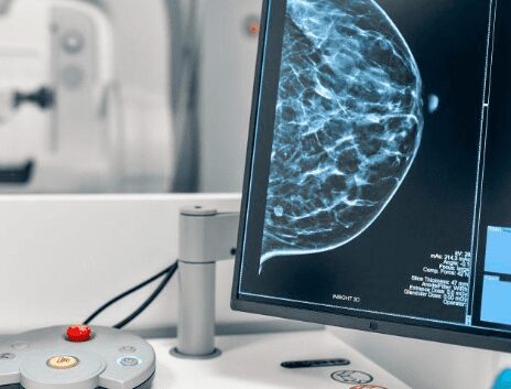 Noticias de la Comarca de Axarquía